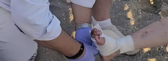 Tpόμος σε παραλία της Αττικής – Θαλάσσια χελώνα έκοψε δάχτυλο γυναίκας και επιτέθηκε σε άλλους δύο λουόμενους