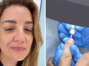 Περιπέτεια υγείας για την Παπίλα: «Όλα ξεκίνησαν όταν άρχισα να βλέπω στα νύχια μου κάτι μικρές γραμμές»