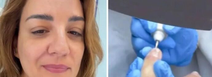 Περιπέτεια υγείας για την Παπίλα: «Όλα ξεκίνησαν όταν άρχισα να βλέπω στα νύχια μου κάτι μικρές γραμμές»