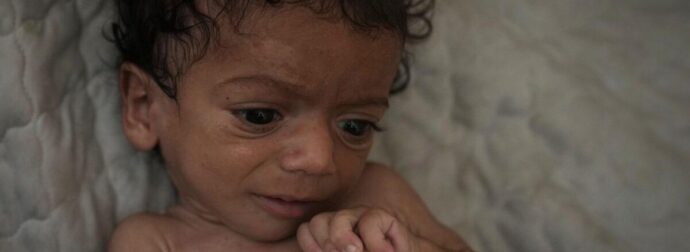 ΕΚΤΑΚΤΗ ΕΙΔΗΣΗ ΣΟΚ – ΕΠΙΒΕΒΑΙΩΘΗΚΕ ΤΟ ΧΕΙΡΟΤΕΡΟ ΣΕΝΑΡΙΟ – ΑΠΕΙΛΟΥΝΤΑΙ ΜΕ ΘΑΝΑΤΟ 132.000 ΠΑΙΔΙΑ ΚΑΤΩ ΤΩΝ 5 ΕΤΩΝ