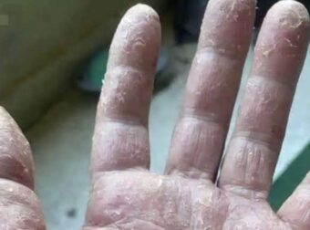 Αυτά είναι τα σημάδια ότι είναι…