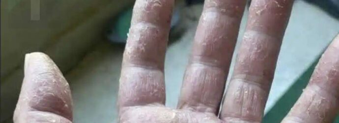 Αυτά είναι τα σημάδια ότι είναι…