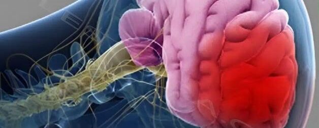 4 πράγματα που πολλοί κάνουν το πρωί και μπορεί να πάθουν εγκεφαλικό, όλες οι ηλικίες πρέπει να τα αποφεύγουν