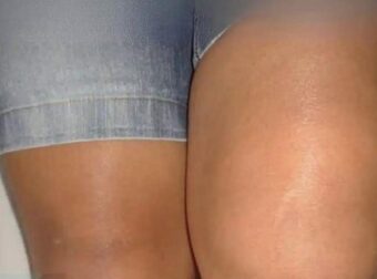 Αν δείτε ένα πόδι πρησμένο, είναι σημάδι…