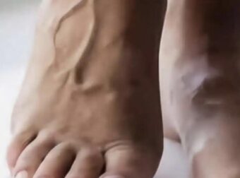 5 συμπτώματα στις γυναίκες που δείχνουν ότι έρχεται καρδιακή προσβολή