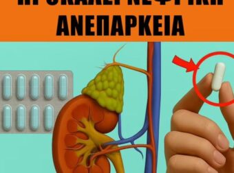 Η λήψη αυτού μπορεί να επηρεάζει τα νεφρά σας – συμβουλευτείτε τον γιατρό σας!