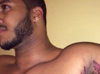 Όπως έκανε μπάνιο ένιωσε κάτι να τον καίει κάτω από τη μασχάλη: Δεν ήταν το σαπούνι αλλά κάτι ΧΕΙΡΟΤΕΡΟ