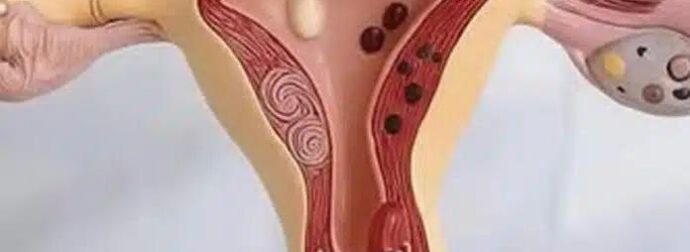 Έτσι αντιδρά το σώμα όταν…