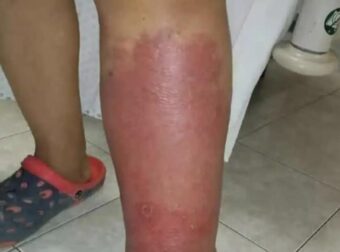 Αυτά Είναι Ξεκάθαρα Σημάδια Ότι Είναι