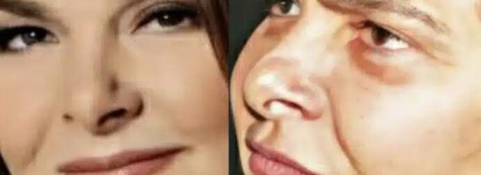 Αγνώριστη σήμερα στα 65 η πασίγνωστη τραγουδίστρια μεγάλων επιτυχιών