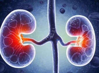 Η διατροφή που «σώζει» τα νεφρά – Τι να κόψετε αμέσως και τι να τρώτε κάθε μέρα