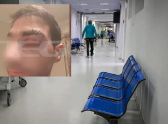 Αίγιο: Πέθανε ο 43χρονος ασθενής μποξέρ που γρονθοκόπησε το γιατρό – Τι λέει ο ορθοπεδικός για την επίθεση