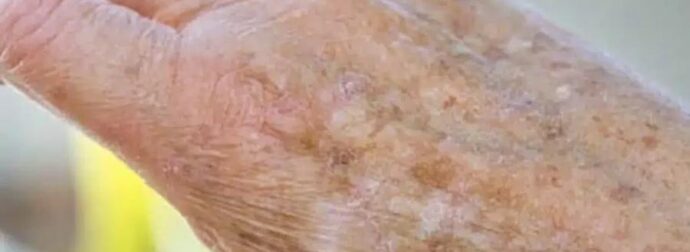 Γνωρίζατε ότι αν εμφανιστούν κηλίδες στα χέρια σας, είναι ξεκάθαρο σημάδι ότι…