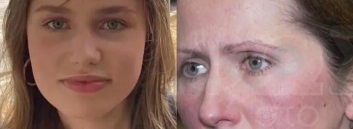 ΕΚΤΑΚΤΟ: Εσπευσμένα στη Γερμανία ο πατέρας της Λόρα – Φόβοι πως…