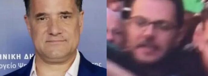 Άδωνις Γεωργιάδης: «Ο “καλός” και “αδικημένος” γιατρός από τη Νίκαια ήθελε απόδειξη ότι με κτύπησε, δείτε τη γροθιά του»