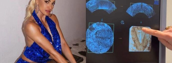 Η Ιωάννα Τούνη το τερμάτισε: Πήρε τους φίλους της στα social ακόμη και στην γυναικολόγο για να αποκαλύψει ότι έχει βάλει σπιράλ