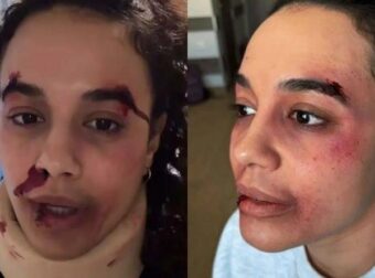 Σάλος στο διαδικτυο με την ηθοποιό Πηνελόπη Πλάκα «Ποιος σου το έκανε αυτό;»: