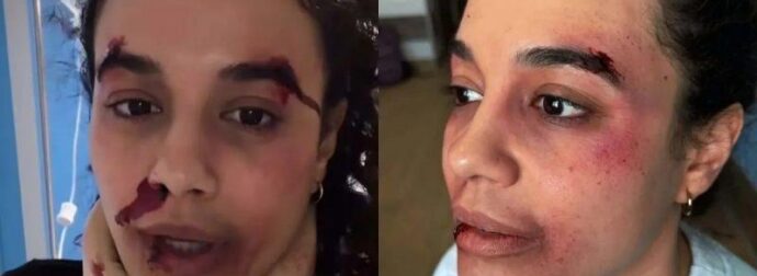 Σάλος στο διαδικτυο με την ηθοποιό Πηνελόπη Πλάκα «Ποιος σου το έκανε αυτό;»: