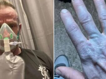 Σοκαριστικό περιστατικό σε νοσοκομείο! “Θεέ μου, συγγνώμη” – Οι γιατροί “πάγωσαν” – Ήταν όλος μπλε και…