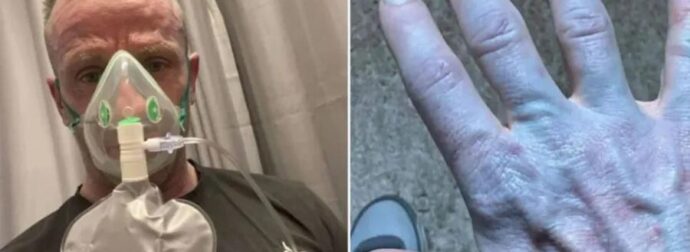 Σοκαριστικό περιστατικό σε νοσοκομείο! “Θεέ μου, συγγνώμη” – Οι γιατροί “πάγωσαν” – Ήταν όλος μπλε και…