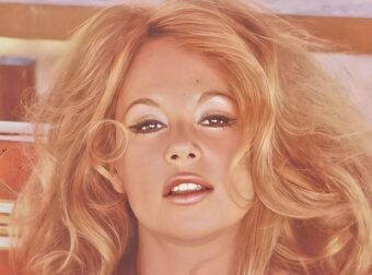 Απίστευτο: Έκανε τις ίδιες θεραπείες με την Αλίκη και «έφυγε» και αυτή στα 62